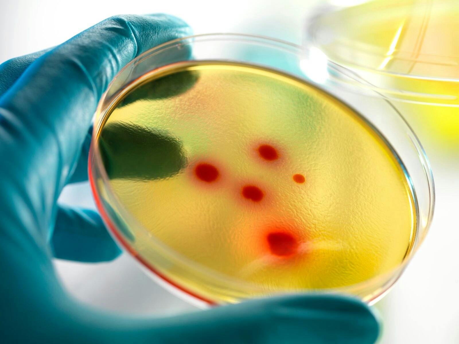 Petri Dish Containing Cultured Bacteria